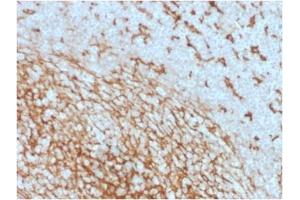 ABIN6383875 to CD14 was successfully used to stain membranes of macrophages in human lymph node and tonsil sections.