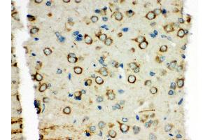 Anti-XRCC3 antibody, IHC(P) IHC(P): Rat Brain Tissue