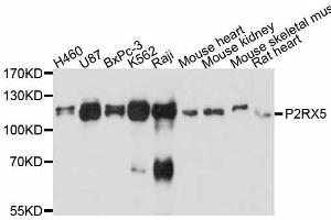 Western blot analysis of extracts of various cell lines, using P2RX5 antibody. (P2RX5 anticorps)