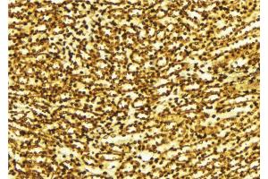 ABIN6274203 at 1/100 staining Human gastric tissue by IHC-P.