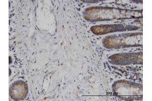 Immunoperoxidase of monoclonal antibody to USP45 on formalin-fixed paraffin-embedded human small Intestine.