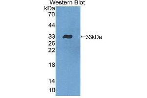 Western blot analysis of the recombinant protein. (Dystrobrevin beta anticorps  (AA 1-249))