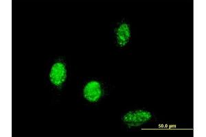 Immunofluorescence of monoclonal antibody to TBX6 on HeLa cell. (T-Box 6 anticorps  (AA 191-299))