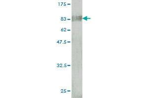 Western Blot detection against Immunogen (85.