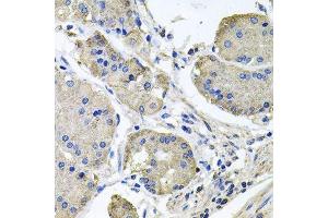 Immunohistochemistry of paraffin-embedded human stomach using NDUFA6 antibody.