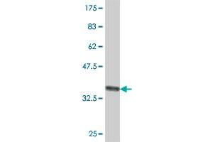 Western Blot detection against Immunogen (37.