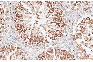 Immunohistochemistry of paraffin-embedded Mouse testis using KIF2C Polyclonal Antibody at dilution of 1:100 (40x lens).