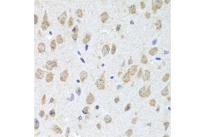 Immunohistochemistry of paraffin-embedded mouse brain using CXCL8 antibody (ABIN6290535) at dilution of 1:100 (40x lens).