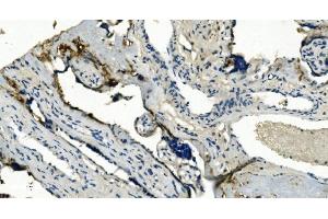 IHC analysis of TMBIM1 using anti-TMBIM1 antibody (ABIN7603190). (TMBIM1 anticorps  (N-Term))