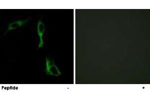 Immunofluorescence analysis of HeLa cells, using ADRA1D polyclonal antibody . (ADRA1D anticorps)