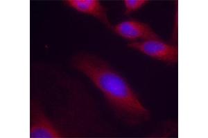 Immunofluorescence (IF) image for anti-Nuclear Factor-kB p65 (NFkBP65) (pSer536) antibody (ABIN1870578) (NF-kB p65 anticorps  (pSer536))
