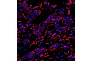 Immunofluorescence (IF) image for anti-Chloride Intracellular Channel 6 (CLIC6) antibody (ABIN7073478)