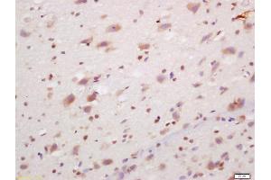 Formalin-fixed and paraffin embedded rat brain labeled with Anti-PCP4/PEP-19 Polyclonal Antibody, Unconjugated (ABIN1385742) at 1:200, followed by conjugation to the secondary antibody and DAB staining (PCP4 anticorps  (AA 21-62))