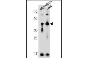 KIR2DL2 Antibody (C-Term) (ABIN651949 and ABIN2840471) western blot analysis in MDA-M,Jurkat cell line lysates (35 μg/lane). (KIR2DL2 anticorps  (C-Term))
