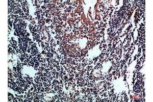 Immunohistochemical analysis of paraffin-embedded Human-tonsil, antibody was diluted at 1:100 (CD8 anticorps  (AA 100-160))