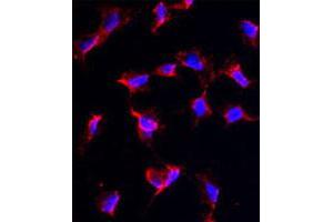 Immunofluorescence analysis of NANOS1 polyclonal antibody  in HeLa cells. (Nanos Homolog 1 anticorps  (C-Term))