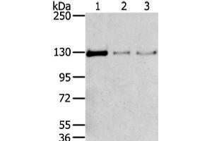 Western Blot analysis of 293T, 231 and lo2 cell using TRIM24 Polyclonal Antibody at dilution of 1/400 (TRIM24 anticorps)