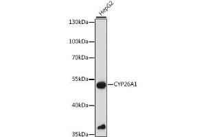 Western blot analysis of extracts of HepG2 cells, using CYP26 antibody (6259) at 1:1000 dilution. (CYP26A1 anticorps  (AA 50-150))