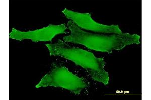 Immunofluorescence of monoclonal antibody to CLIC1 on HeLa cell.