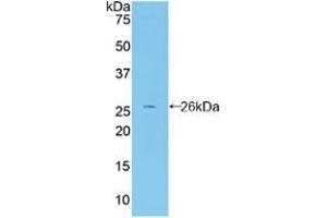 Western blot analysis of recombinant Mouse FBLN2. (FBLN2 anticorps  (AA 896-1106))