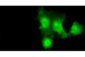 Anti-GBE1 mouse monoclonal antibody (ABIN2453066) immunofluorescent staining of COS7 cells transiently transfected by pCMV6-ENTRY GBE1 (RC204152). (GBE1 anticorps)