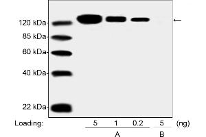 Western blot analysis of PEGylated drug (Pegasys, Peginterferon Alfa 2A) and Non-PEGylated Interferon Alfa 2A protein using the PEG Antibody [Biotin], mAb, Mouse (0.