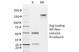 SDS-PAGE Analysis of Purified, BSA-Free EpCAM Antibody (clone EGP40/826).