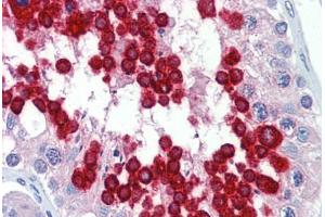 Human Testis (formalin-fixed, paraffin-embedded) stained with JAZF1 antibody ABIN462223 followed by biotinylated goat anti-rabbit IgG secondary antibody ABIN481713, alkaline phosphatase-streptavidin and chromogen.