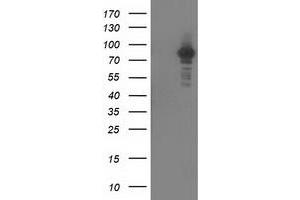 Western Blotting (WB) image for anti-Protein Kinase C, epsilon (PRKCE) antibody (ABIN1500236) (PKC epsilon anticorps)