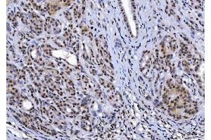 IHC analysis of YY1 using anti-YY1 antibody (ABIN7602999).