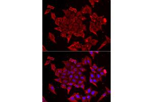 Immunofluorescence analysis of U2OS cell using TIMM17A antibody. (TIMM17A anticorps)