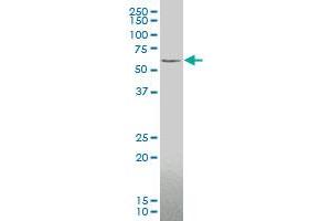 ZIC3 monoclonal antibody (M05), clone 2C1 Western Blot analysis of ZIC3 expression in Y-79 .
