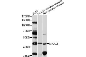 Western blot analysis of extracts of various cell lines, using MICU2 antibody (ABIN5998228) at 1/1000 dilution. (EFHA1 anticorps)