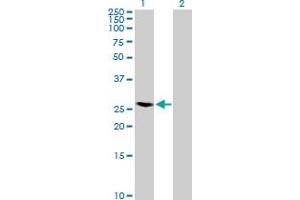 Western Blot analysis of RAB40A expression in transfected 293T cell line by RAB40A MaxPab polyclonal antibody. (RAB40A anticorps  (AA 1-277))