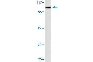 Western blot analysis of A-549 cell lysate with PML polyclonal antibody . (PML anticorps)
