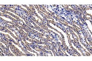 Detection of IL11Ra in Rat Kidney Tissue using Polyclonal Antibody to Interleukin 11 Receptor Alpha (IL11Ra) (IL11RA anticorps  (AA 24-371))
