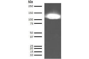 Western Blotting (WB) image for anti-KININOGEN HMW antibody (ABIN613715) (KININOGEN HMW anticorps)