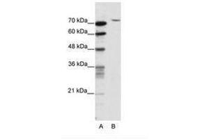 Image no. 1 for anti-TAF6 RNA Polymerase II, TATA Box Binding Protein (TBP)-Associated Factor, 80kDa (TAF6) (N-Term) antibody (ABIN202866) (TAF6 anticorps  (N-Term))