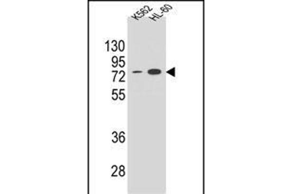 ENTPD3 antibody  (C-Term)