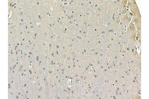 Parkin Mouse Monoclonal Antibody at 1/100 staining rat brain tissue by IHC-P. (Parkin anticorps)