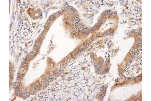 Immunohistochemistry (IHC) image for anti-BH3 Interacting Domain Death Agonist (BID) (AA 60-120) antibody (ABIN7449383)
