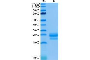 CD99 Protein (CD99) (AA 23-122) (His tag)