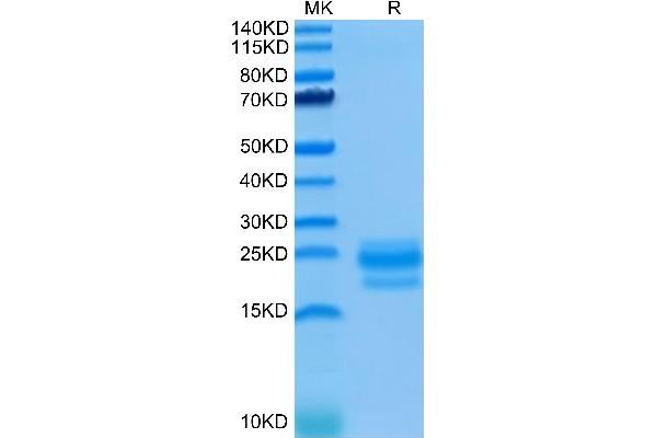 CD99 Protein (CD99) (AA 23-122) (His tag)