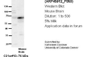 Image no. 2 for anti-Leber Congenital Amaurosis 5-Like (LCA5L) (N-Term) antibody (ABIN2782411) (LCA5L anticorps  (N-Term))