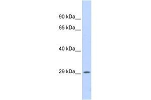 WB Suggested Anti-PSME1 Antibody Titration: 0. (PSME1 anticorps  (Middle Region))
