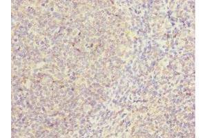 Immunohistochemistry of paraffin-embedded human tonsil tissue using ABIN7146507 at dilution of 1:100 (CAMSAP2 anticorps  (AA 1-150))
