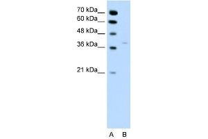 HSD17B1 antibody used at 0. (HSD17B1 anticorps)
