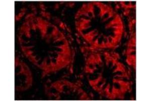 Immunofluorescence of TEM1 in Human Colon cells with TEM1at 20 µg/ml.