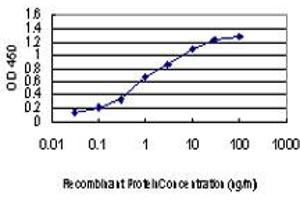 Detection limit for recombinant GST tagged IRAK2 is approximately 0. (IRAK2 anticorps  (AA 111-210))
