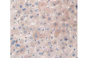 IHC-P analysis of Human Tissue, with DAB staining. (SFRP5 anticorps  (AA 181-303))
